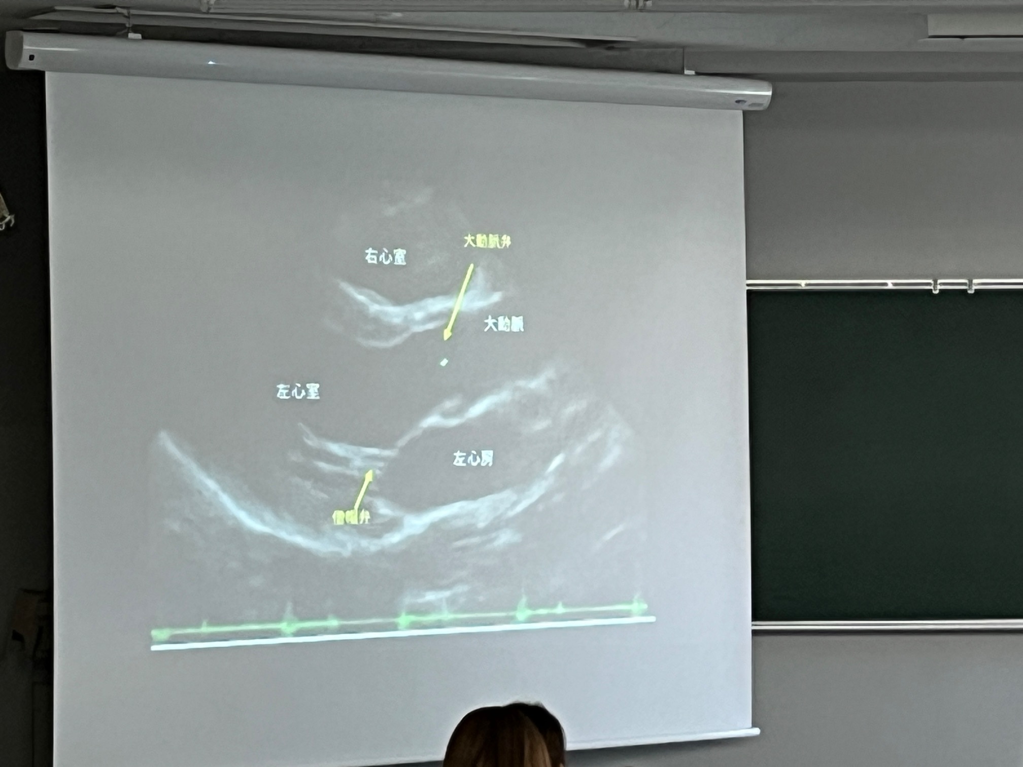 心エコー画像を用いた授業資料